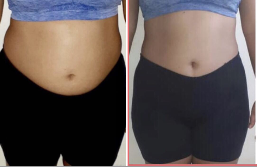 Client transformation