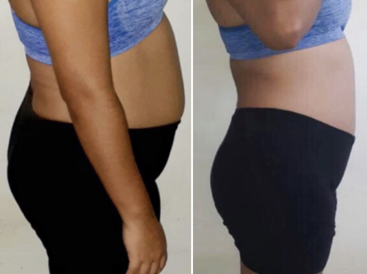 Client transformation
