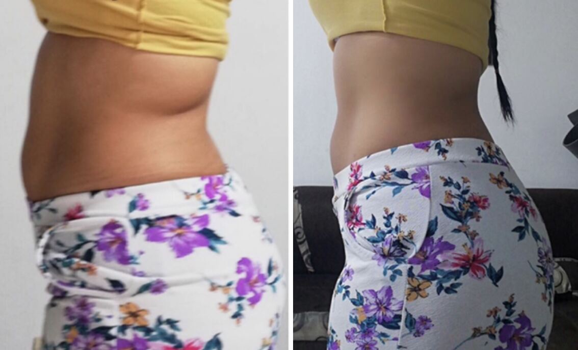 Client transformation