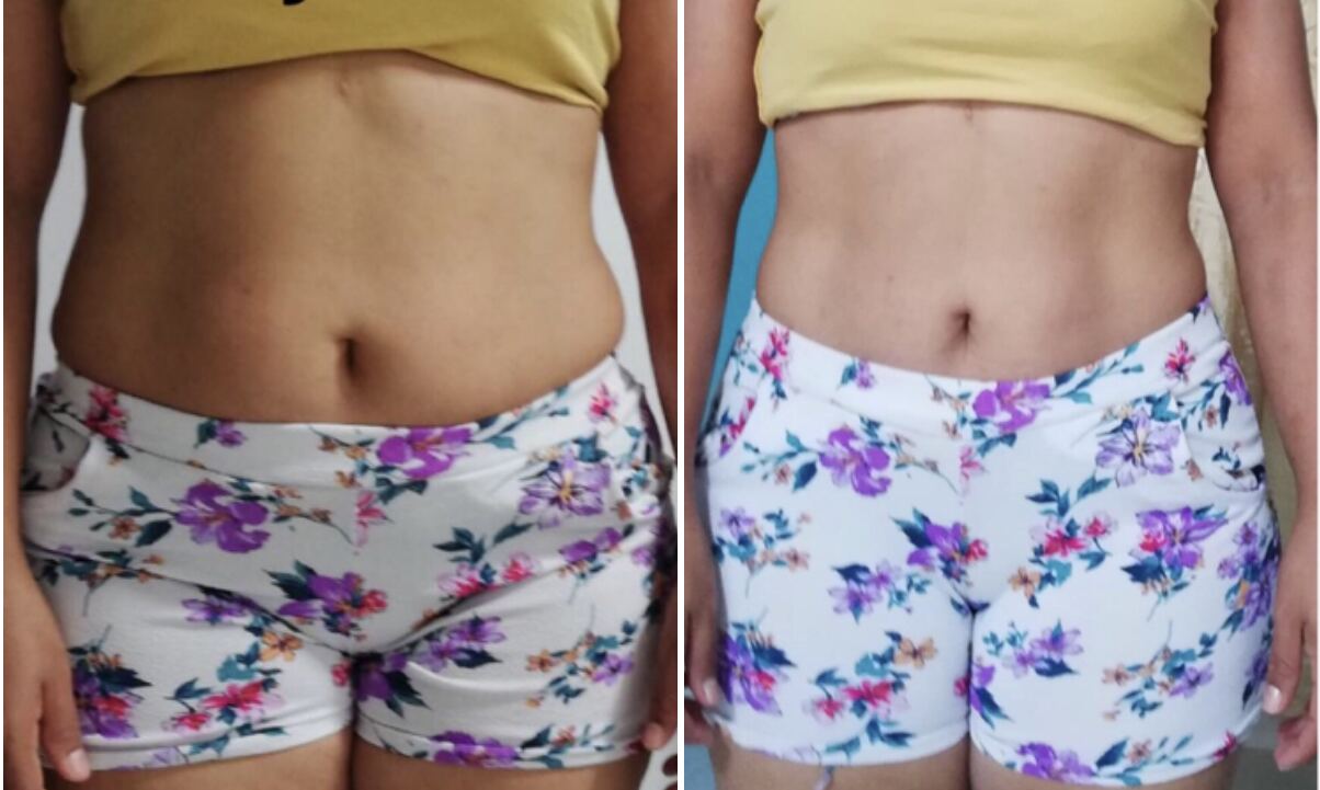 Client transformation