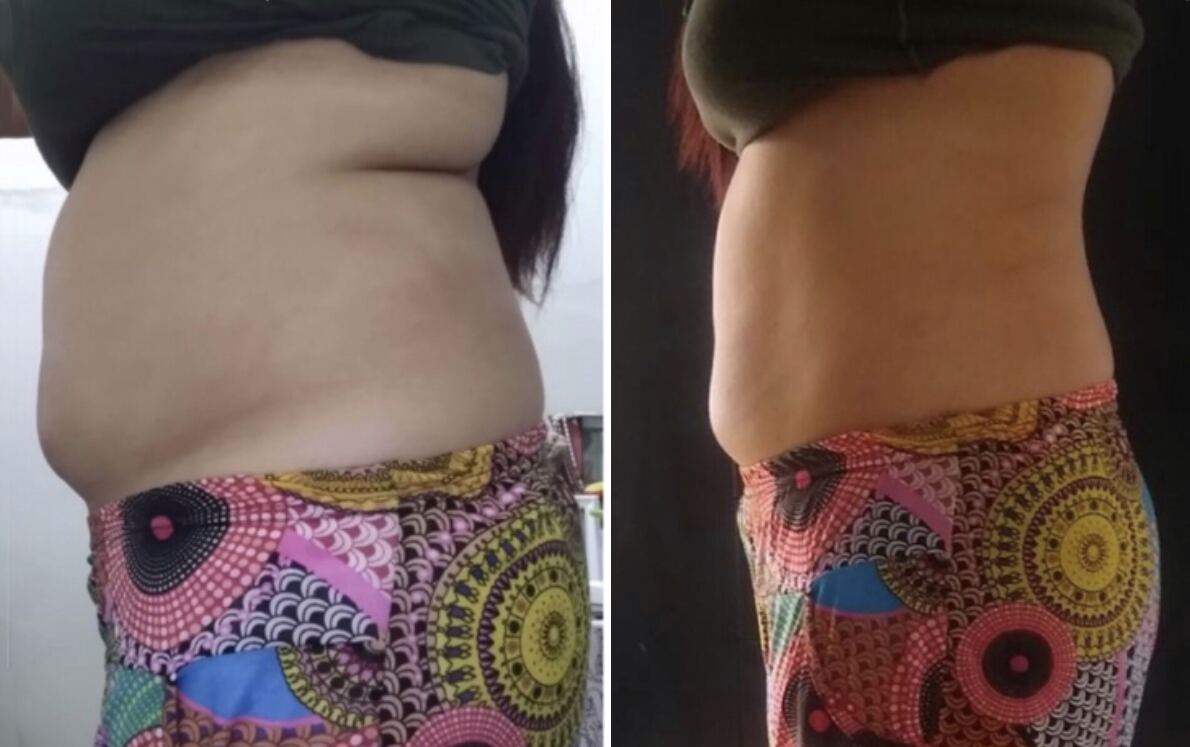 Client transformation