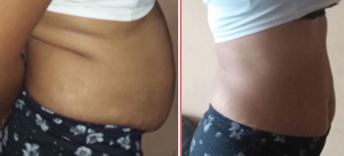 Client transformation