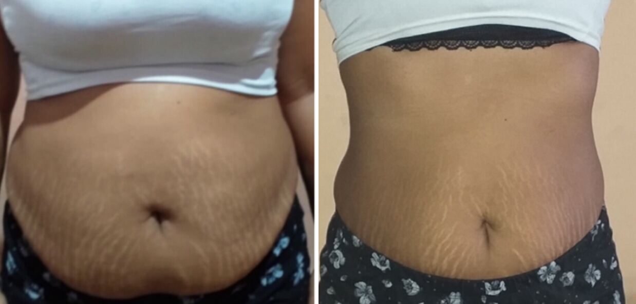 Client transformation