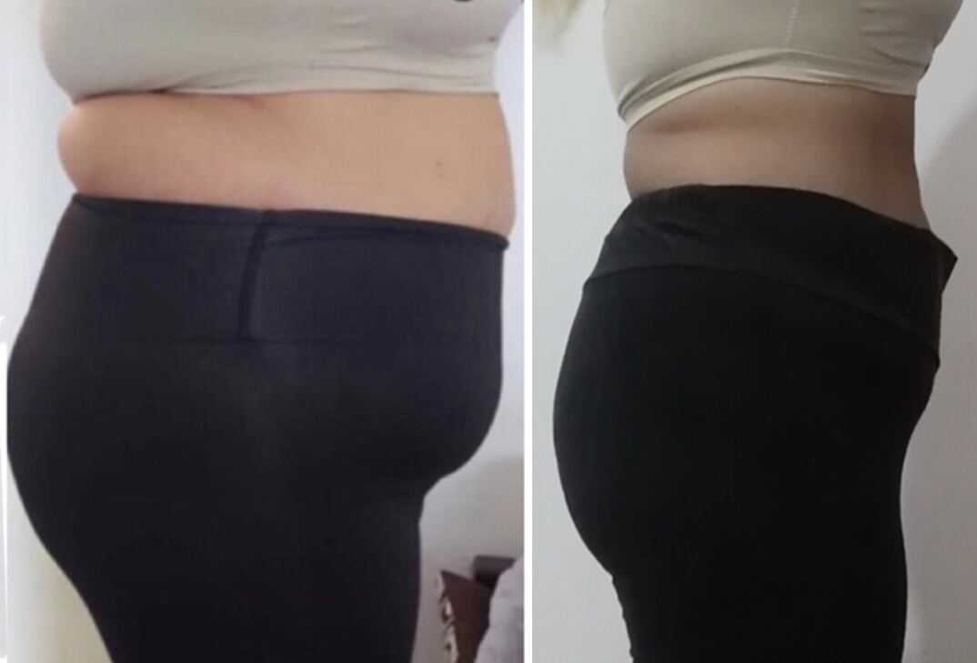 Client transformation