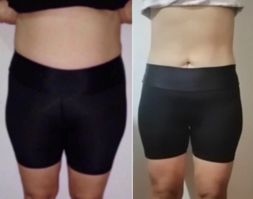 Client transformation