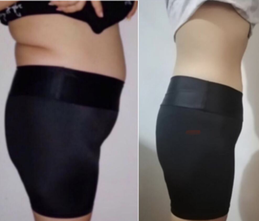 Client transformation