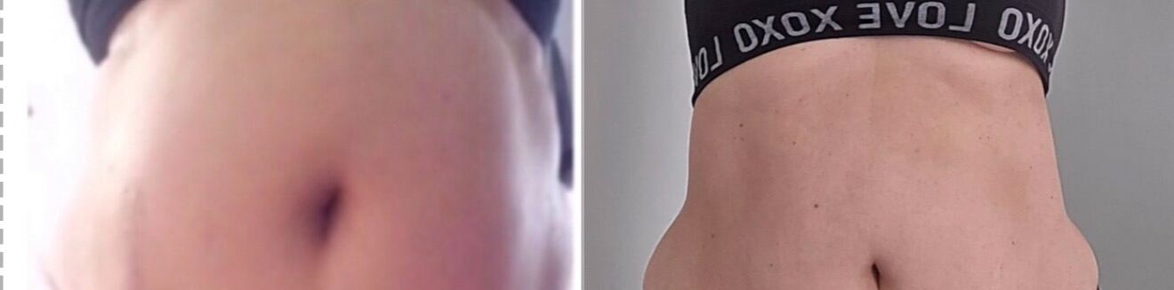 Client transformation