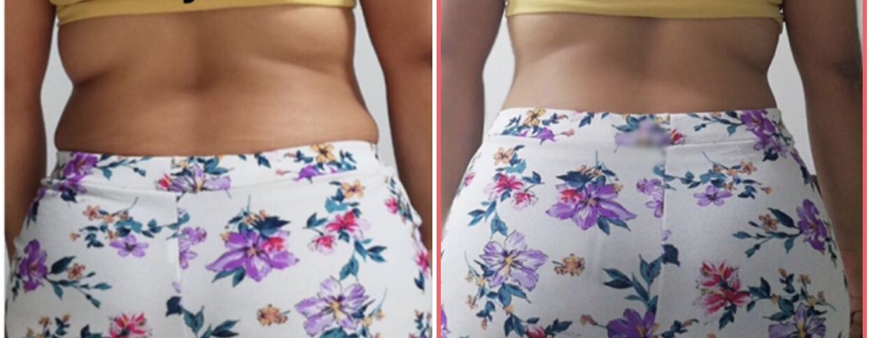 Client transformation