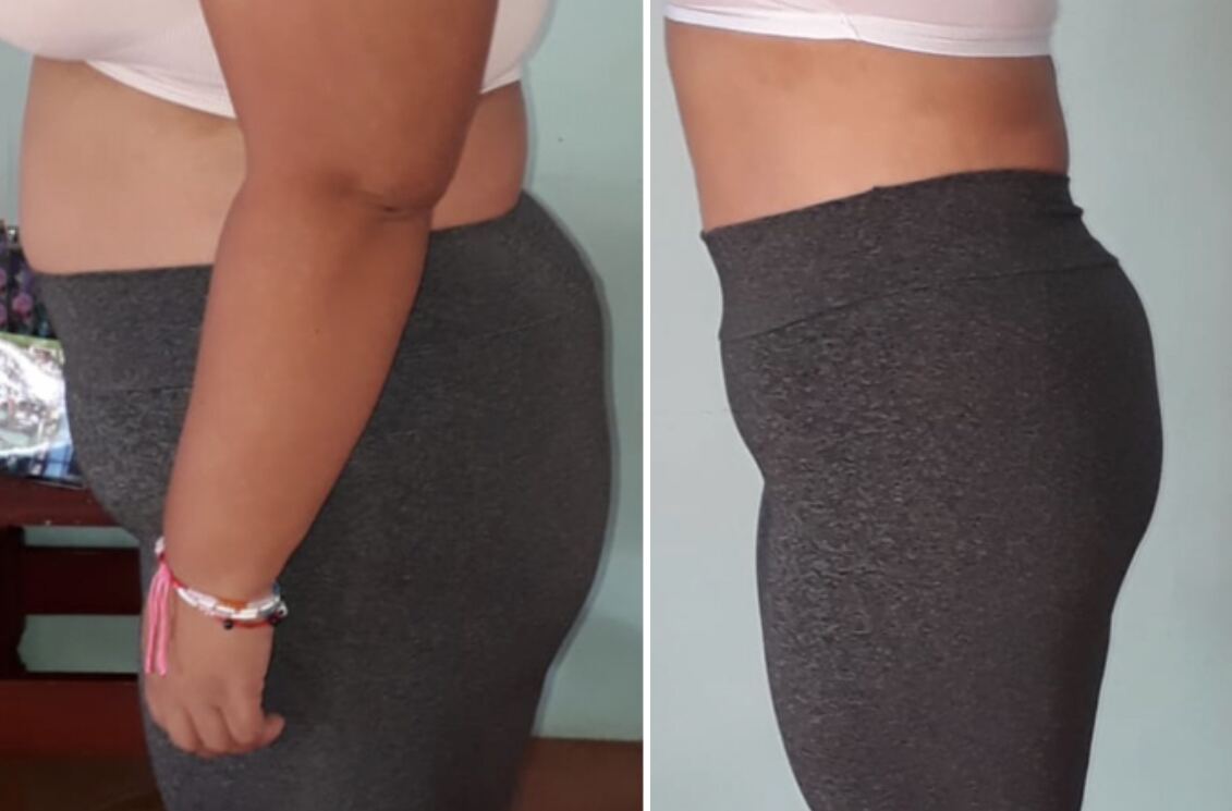Client transformation