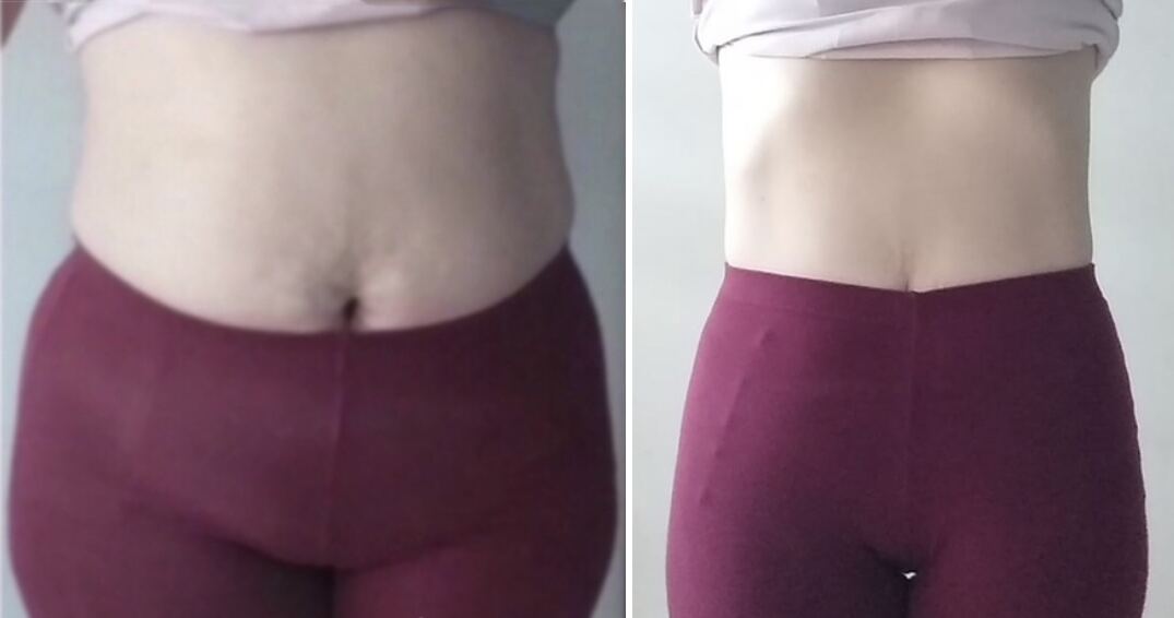 Client transformation