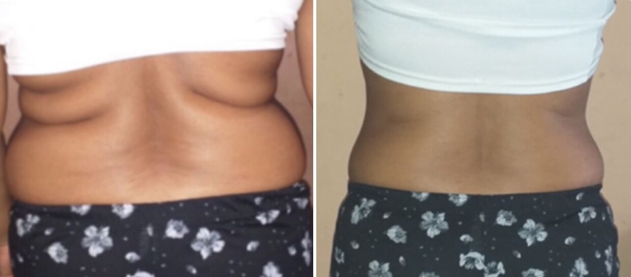 Client transformation
